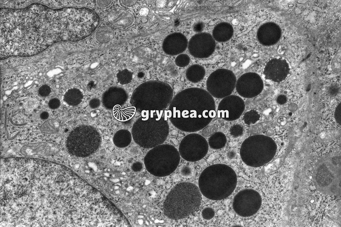 Grains de sécrétion MET x8000 - gryphea.com